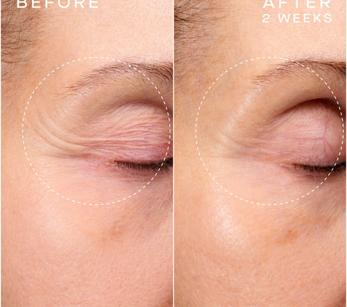 Advanced Regenerative Serum