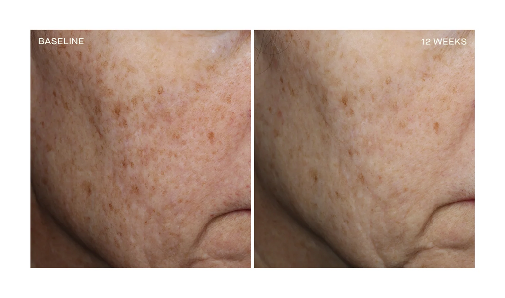 Complexion Brightening Serum