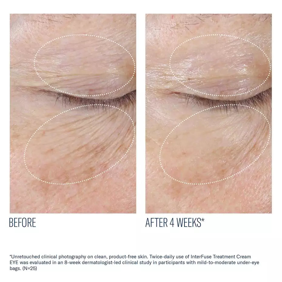 Interfuse Treatment Cream Eye