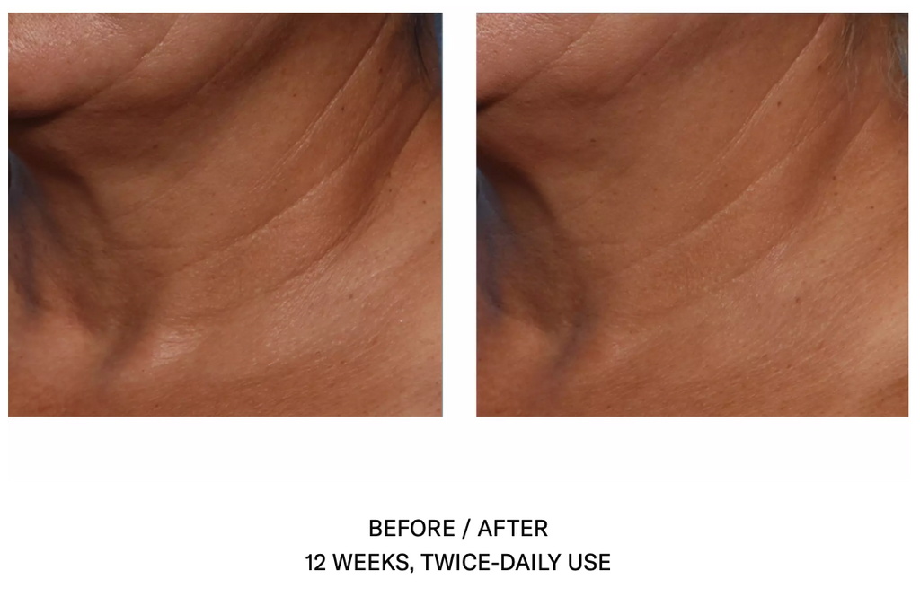 Techno Neck Perfecting Cream