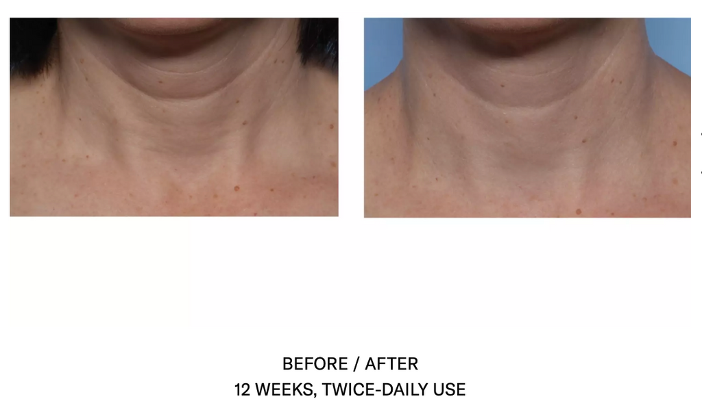 Techno Neck Perfecting Cream
