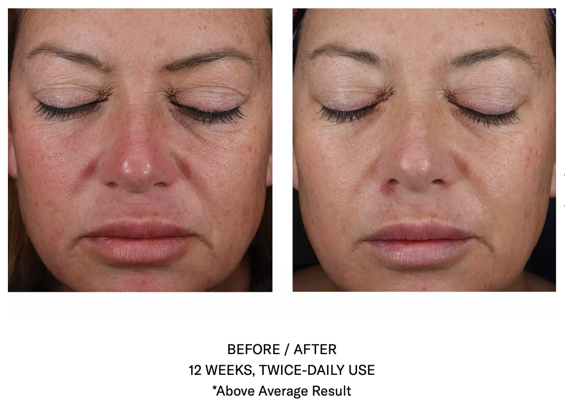 Mystro Active Balance Serum