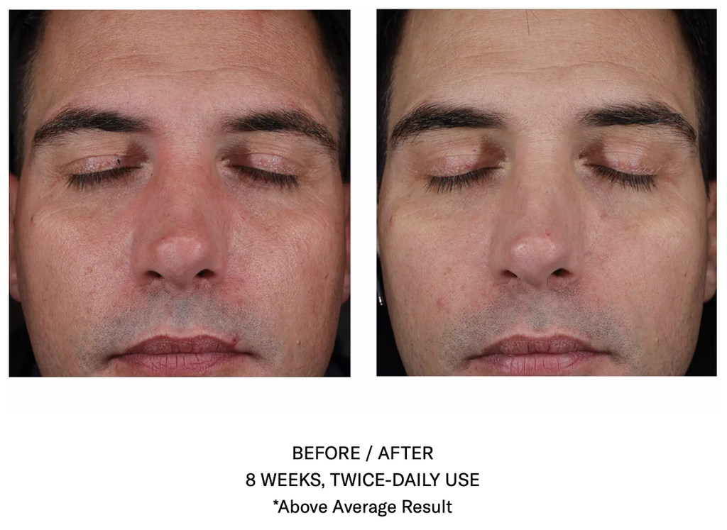 Mystro Active Balance Serum