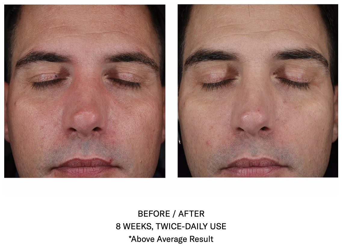 Mystro Active Balance Serum
