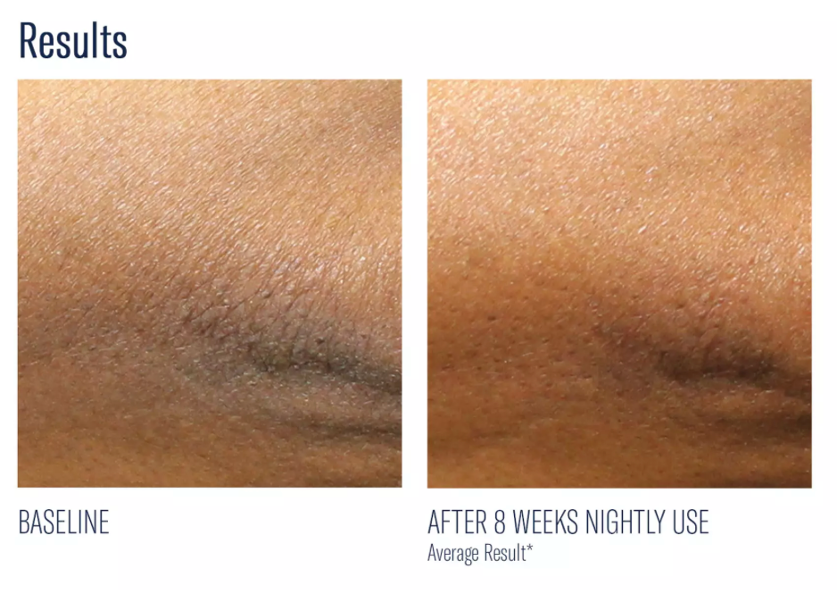 Alpharet Body Overnight Cream