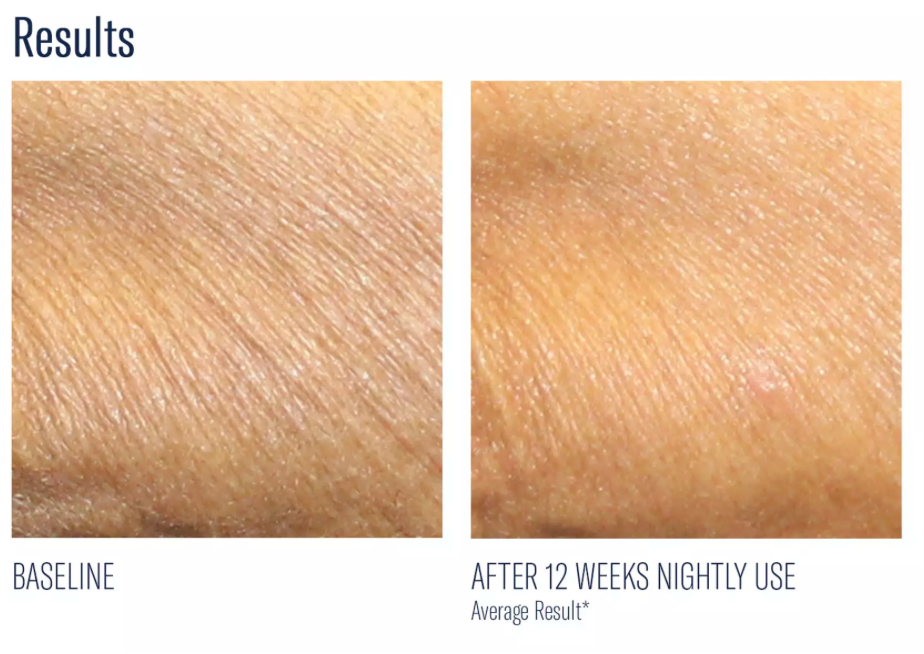 Alpharet Body Overnight Cream