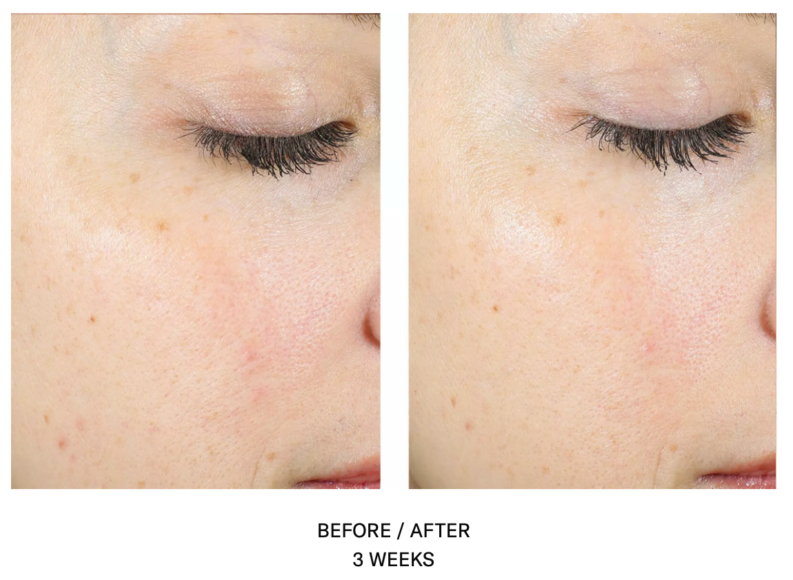 Alpharet Exfoliating Peel Pads