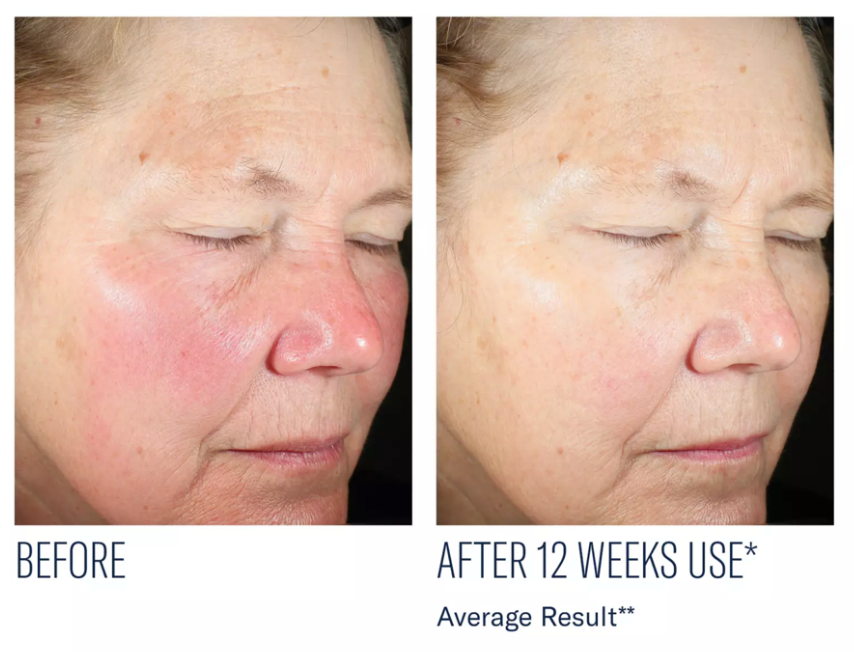Even Intensive Skin Tone Correcting Serum