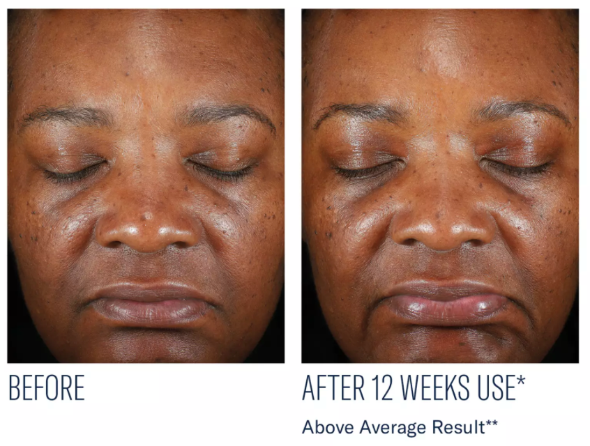 Even Intensive Skin Tone Correcting Serum