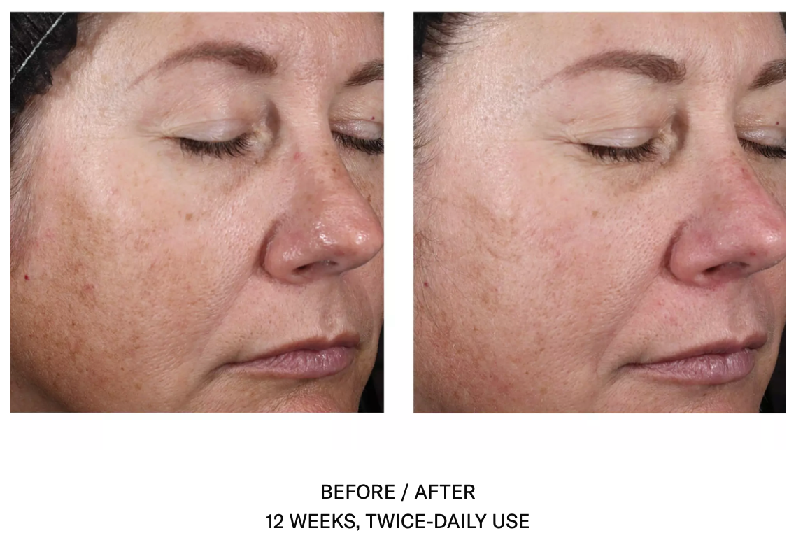 Alto Advanced Defense & Repair Serum
