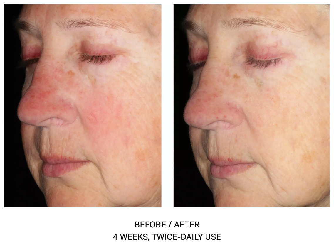 Alto Defense Serum