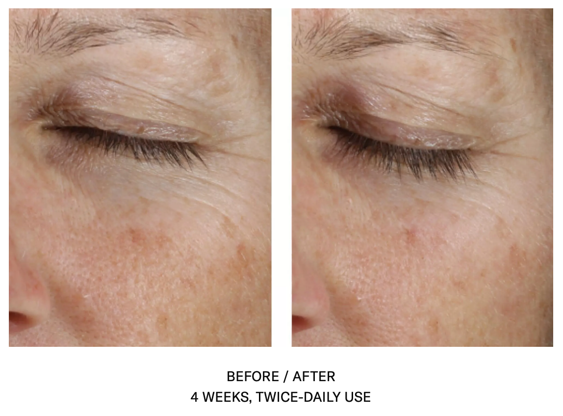 Instant Effect Eye Gel