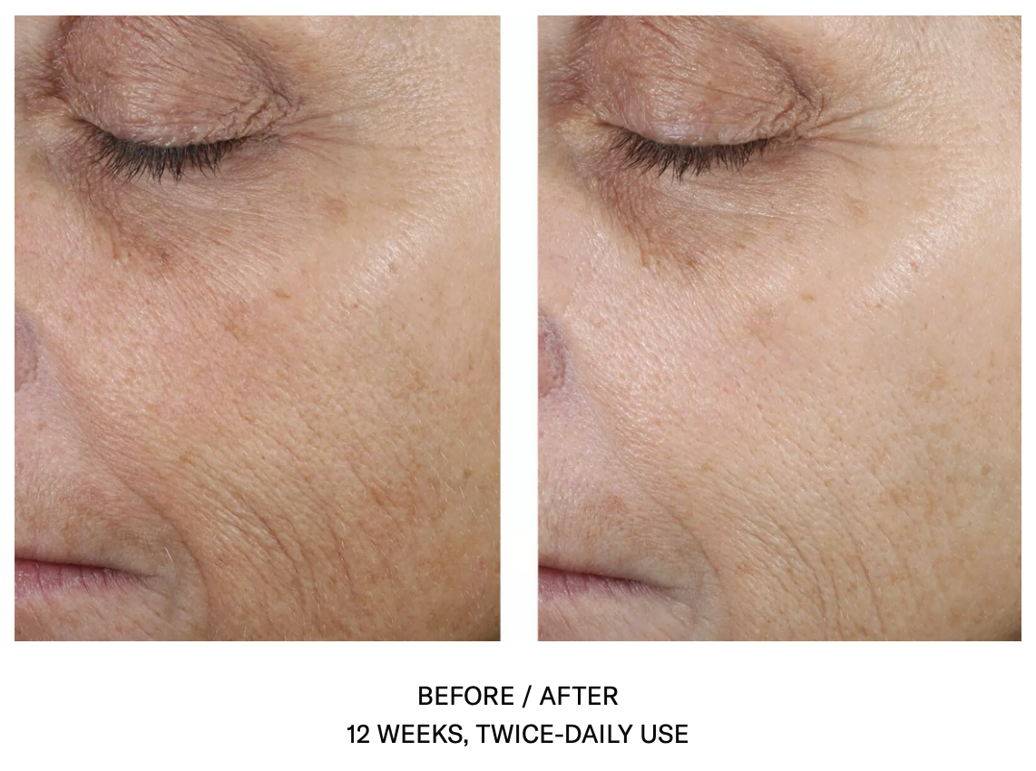 Even Skin Tone Correcting Serum