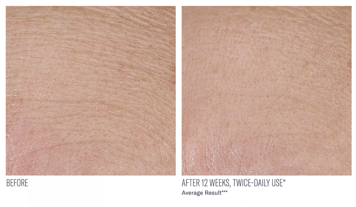 Interfuse Treatment Cream Face & Neck