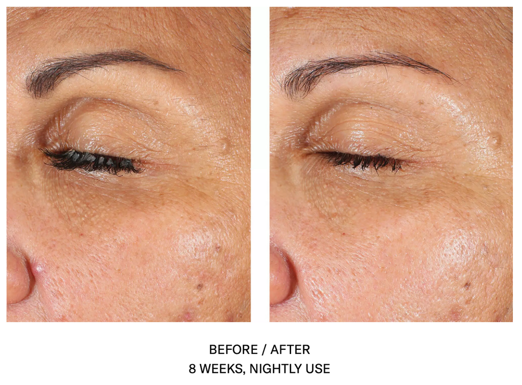 EyeMax Alpharet Overnight Cream