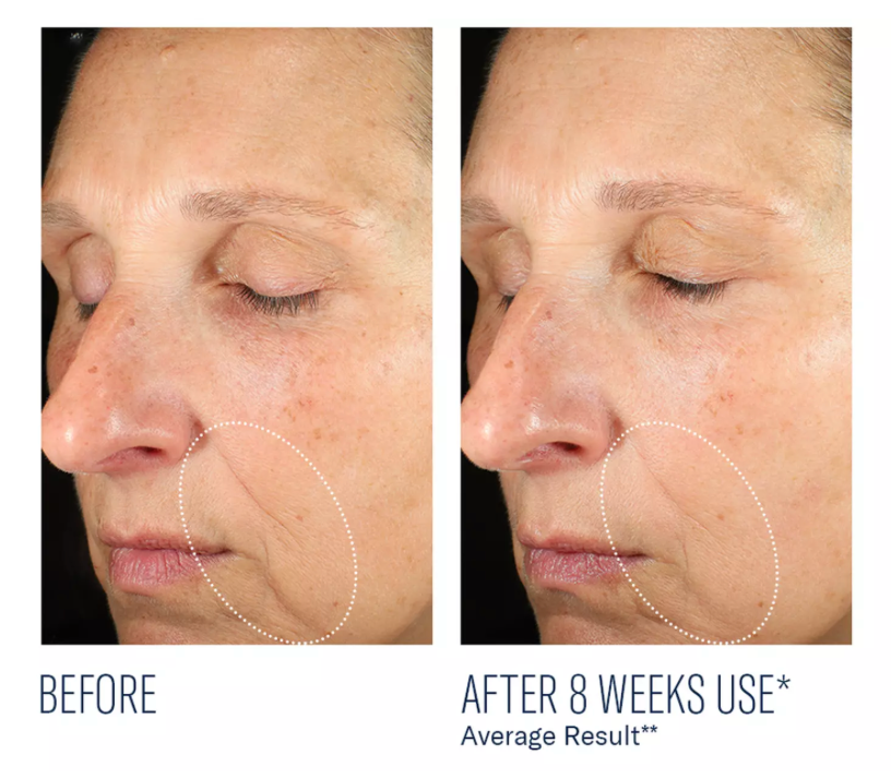Mystro Revive Renewing Serum