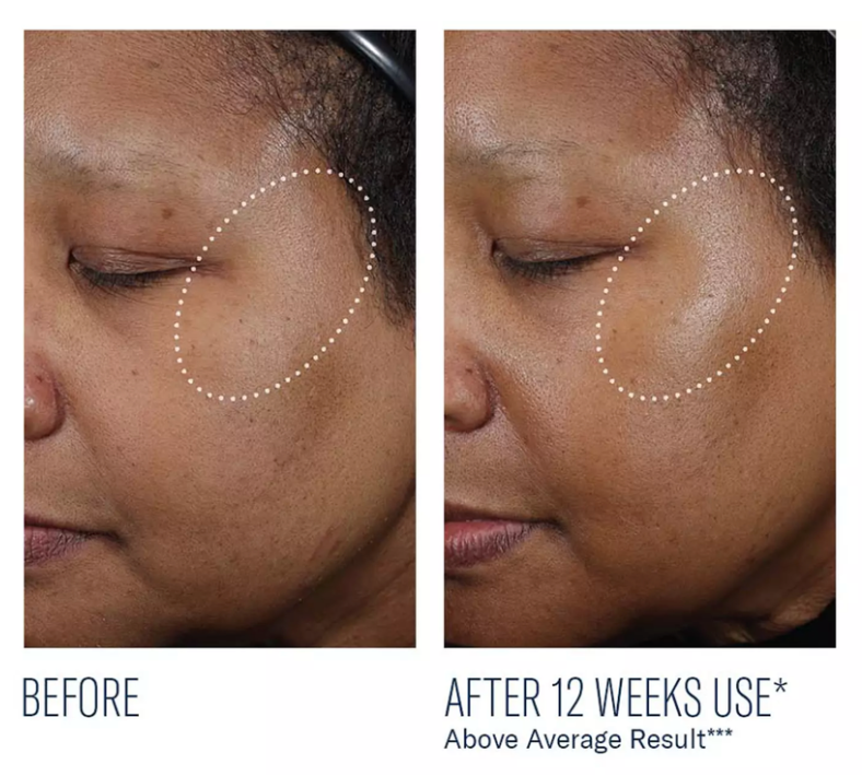 Ampra Volumizing Micro HA Serum